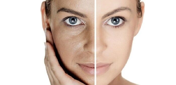 pred a po omladení pokožky tváre