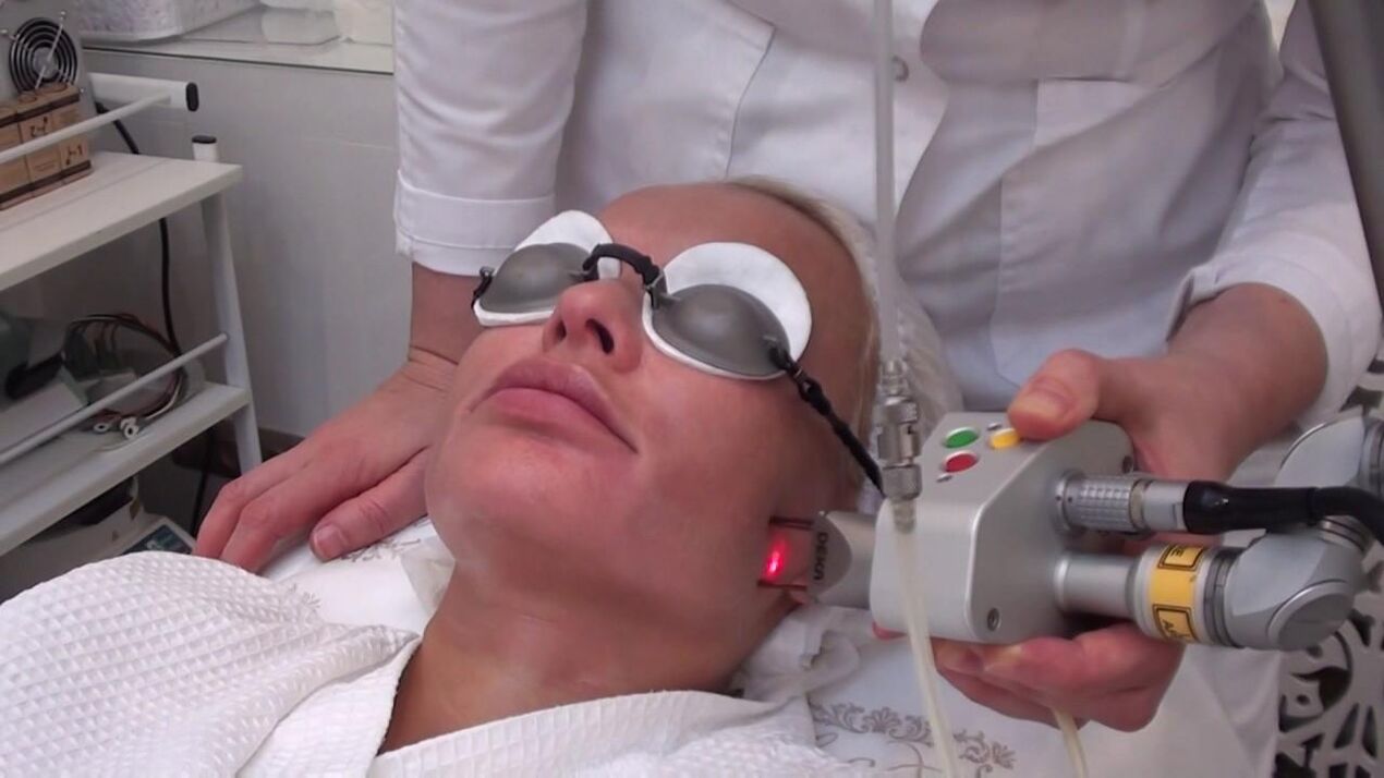 Ošetrenie problémových oblastí pokožky tváre laserovým lúčom