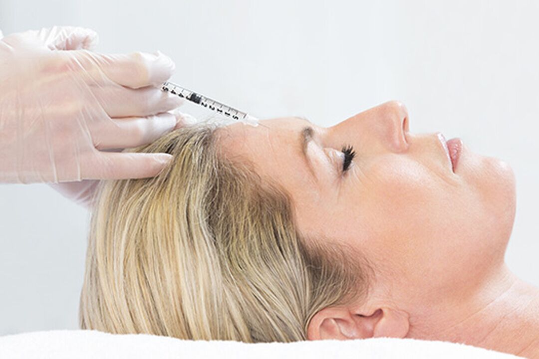 Plazmolifting je injekčná metóda na omladenie pokožky tváre